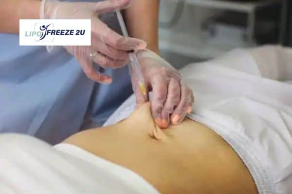 How Does Aqualyx Fat Dissolving Injection Work to Break Down Fat Billingshurst?