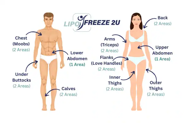 Areas you can have fat freezing treatment Billingshurst