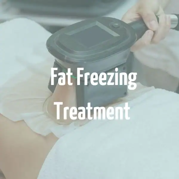 fat freezing treatment Billingshurst
