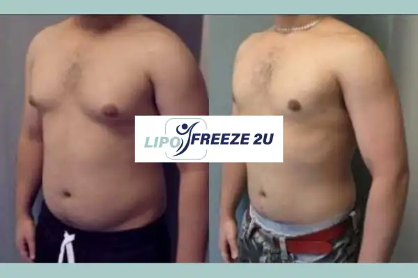 How Long Does It Take to See Results Billingshurst?