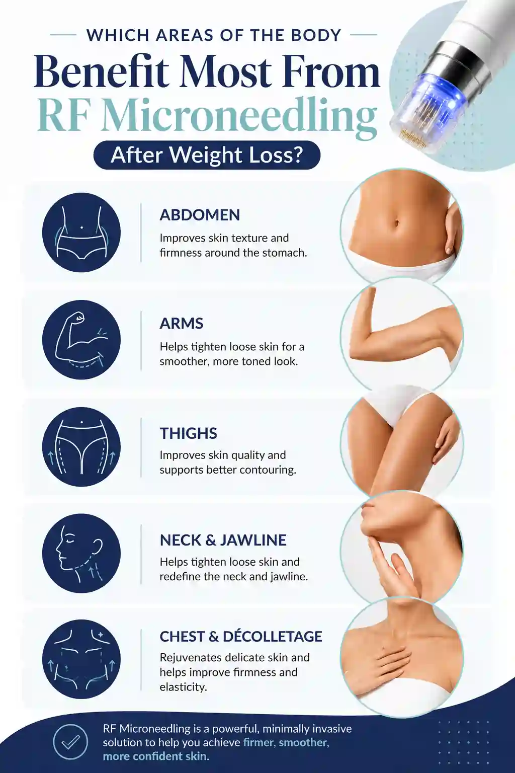 Which Areas of the Body Benefit Most From RF Microneedling After Weight Loss Billingshurst
